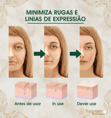 Sérum Rejuvenescedor Hialuronic™